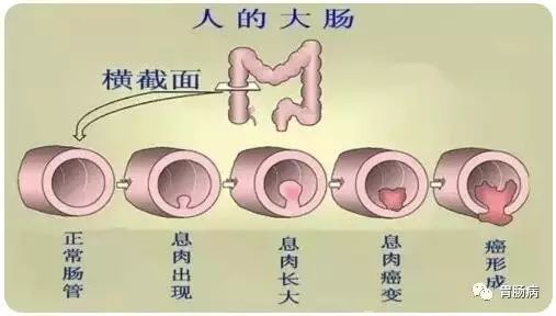 结肠癌补硒量