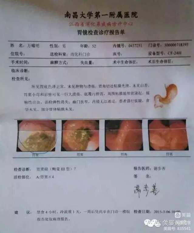 补硒和食管癌