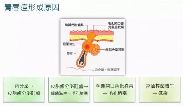 脸上有痤疮要补锌多久