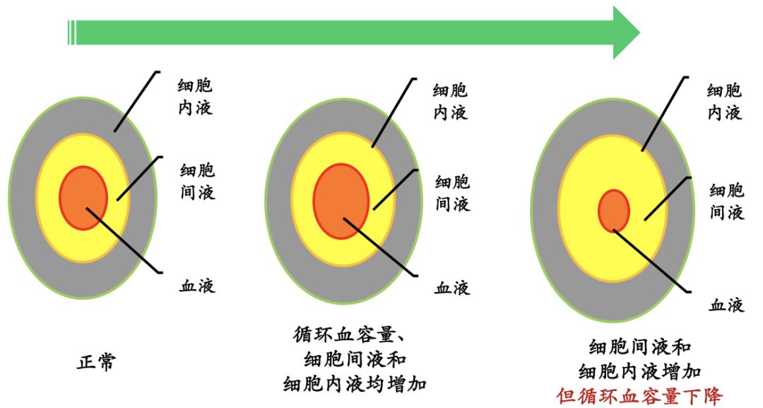 低钠血症补钠计算公式