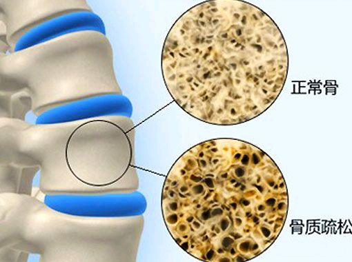 如何给牙齿补钙