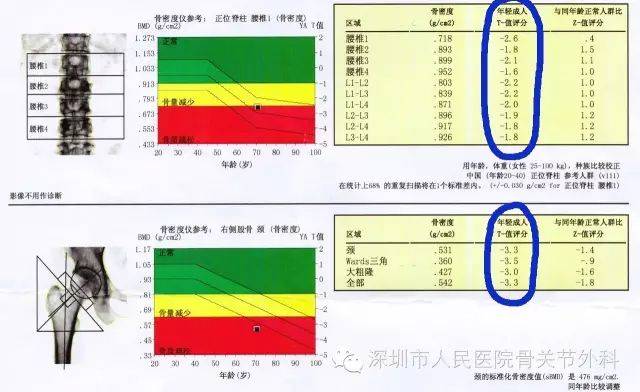 补钙的针剂药物有哪些