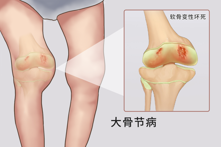 补硒应该吃什么