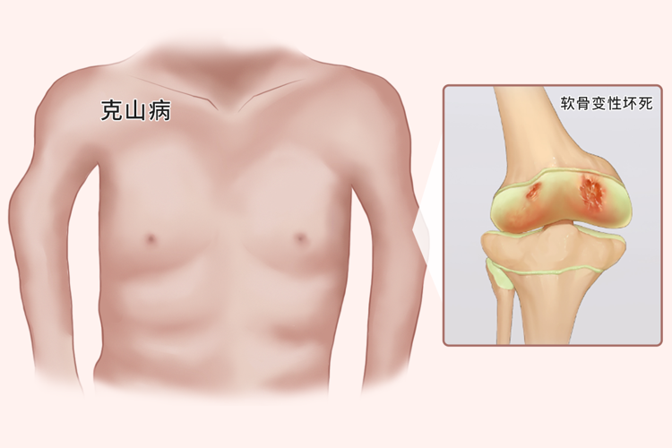 补硒怎么选择硒