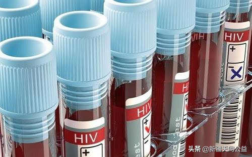 HIV患者补硒