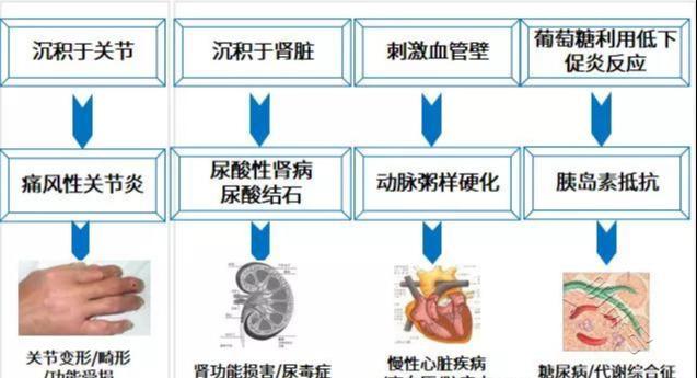 尿酸高能吃钙片补钙吗