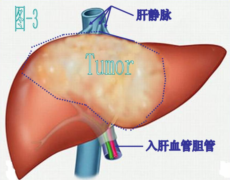 什么食物补硒多