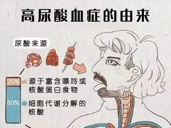 补硒尿酸升高吗