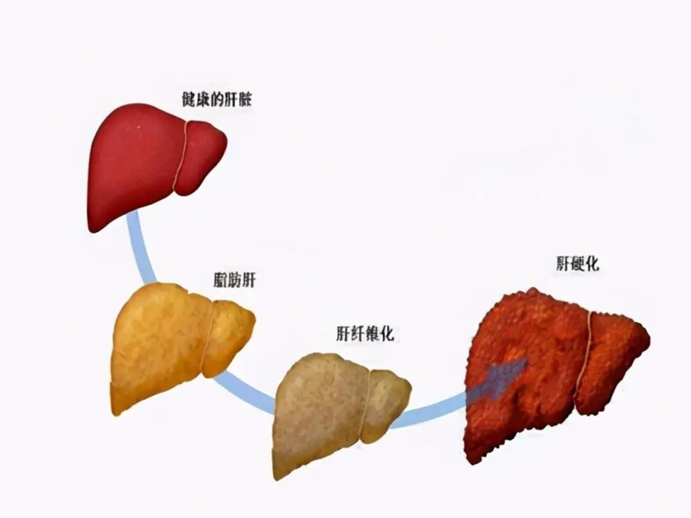 肝硬化怎样补硒