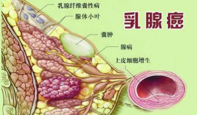 补硒能去肺结节