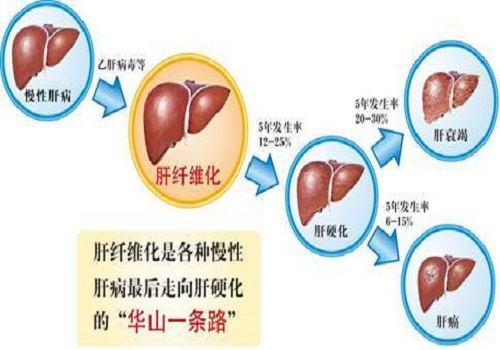 乙肝补硒专家谈