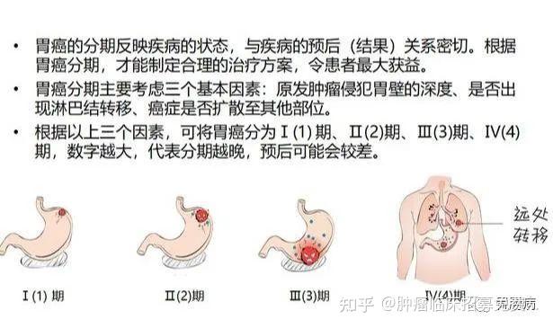 胃萎缩怎样补硒