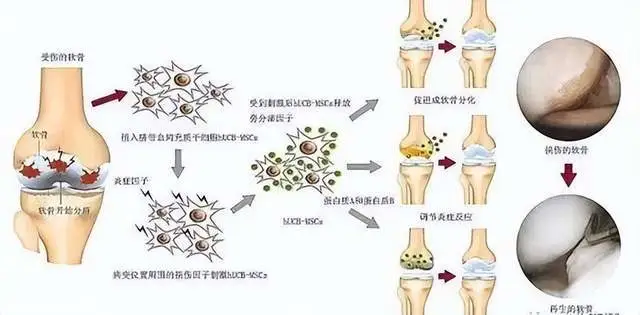 补硒引起骨头疼