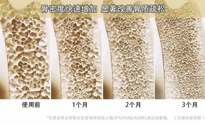 黄瓜籽补钙好还是钙片补钙好