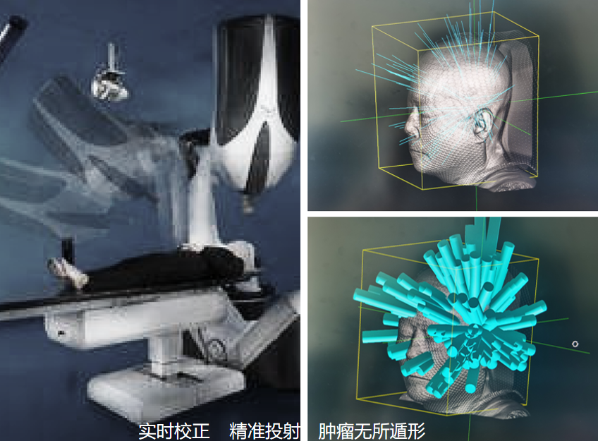 做完伽马刀补硒