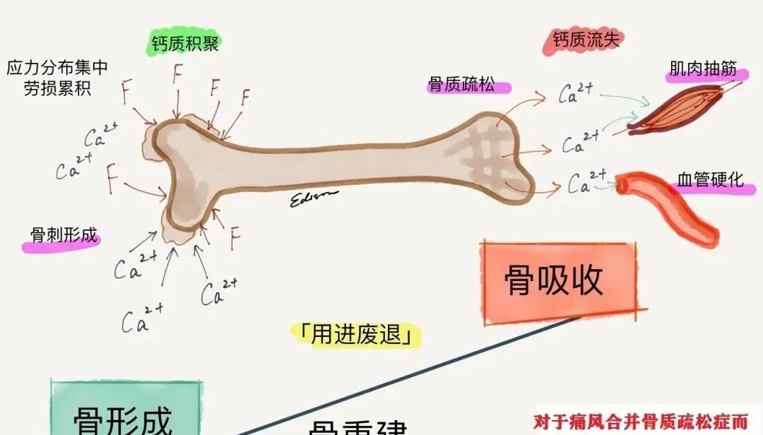 痛风能吃钙片补钙吗