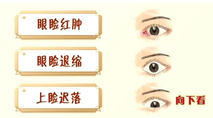 甲亢突眼 补硒