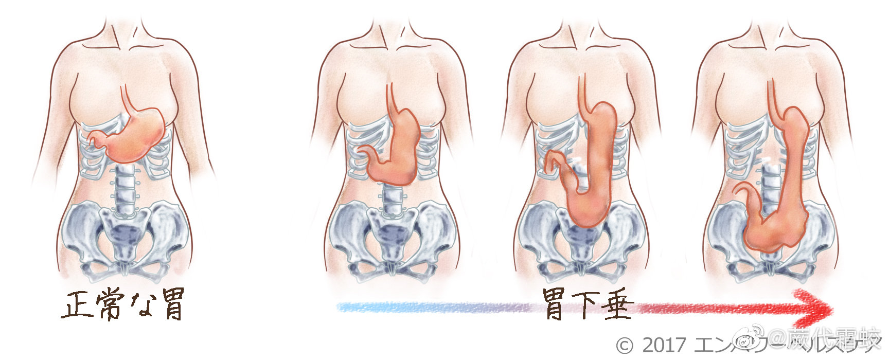 胃下垂补硒治疗