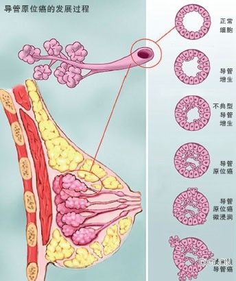 乳腺结节要补硒