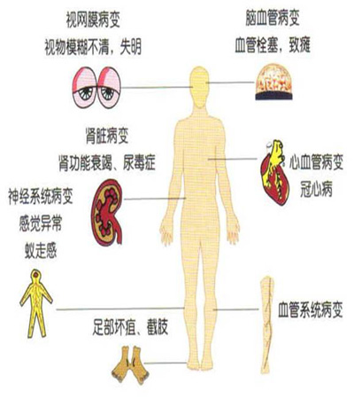 补硒预防脑出血