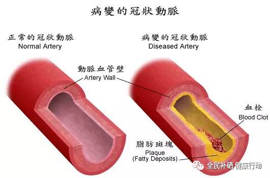 补硒对血糖好吗