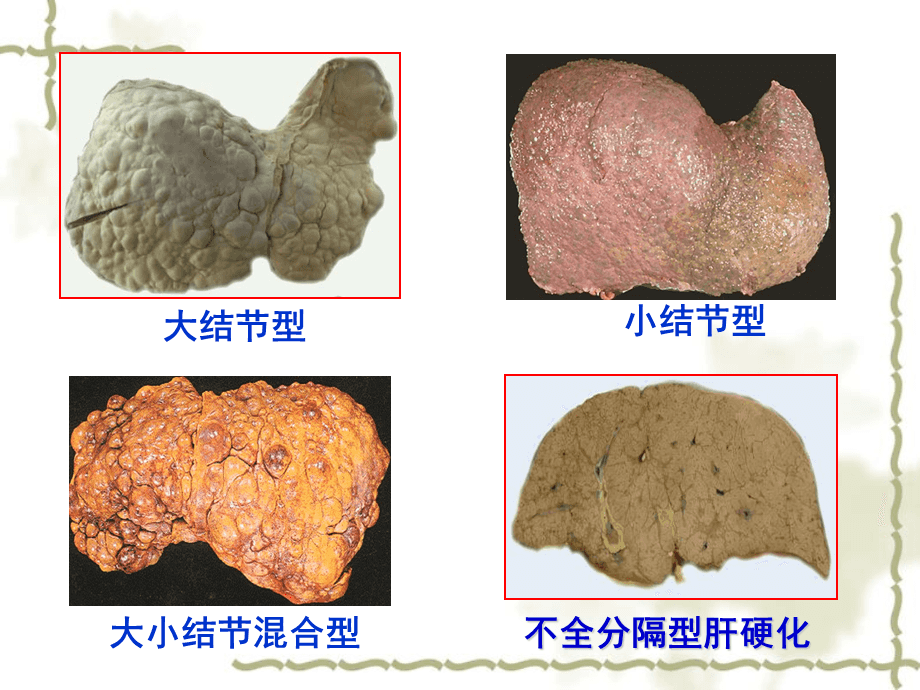 肝硬化什什补硒