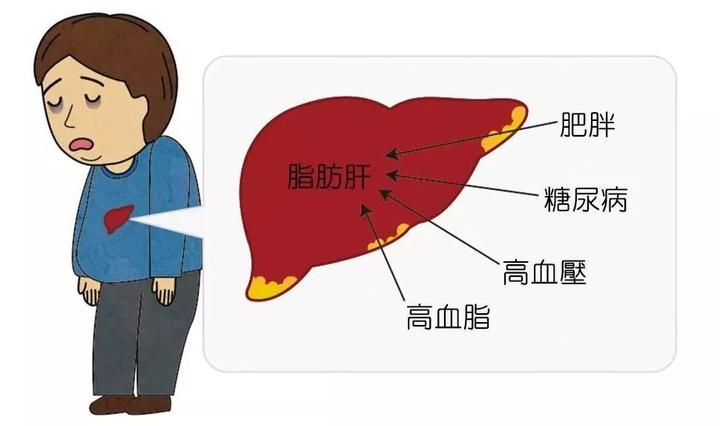 脂肪肝怎么补硒