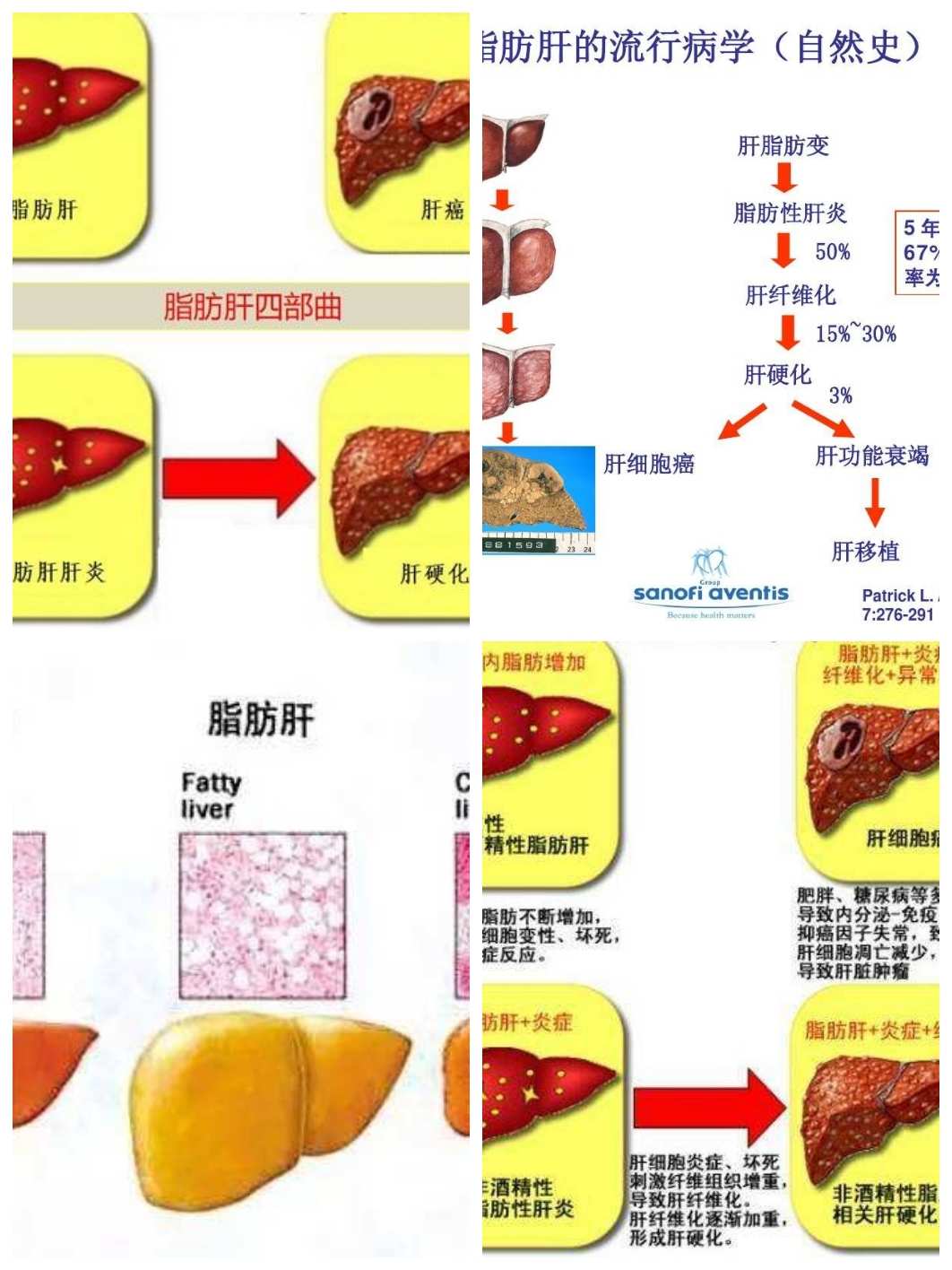 排肝毒怎么补硒