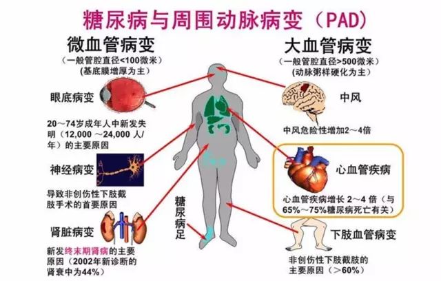 补硒预防糖尿病