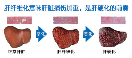 老年人补硒中药