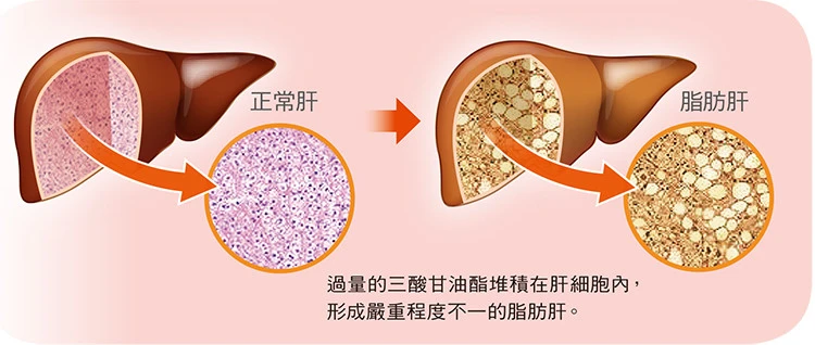 肝衰竭能补硒吗