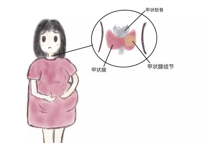 锌硒宝孕妇补碘