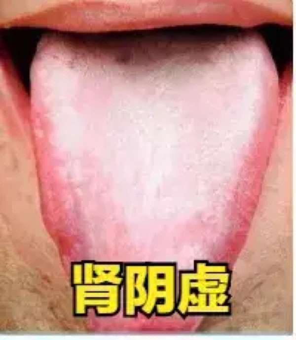 硒吃什么药能补