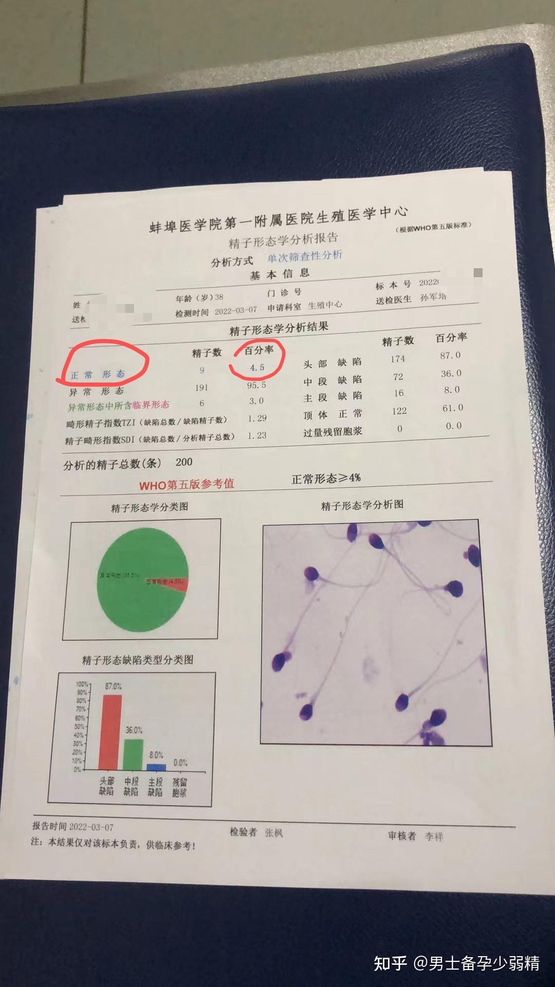 锌硒宝精子畸形