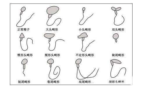 锌硒宝精子畸形