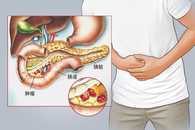 吃锌硒宝片上火