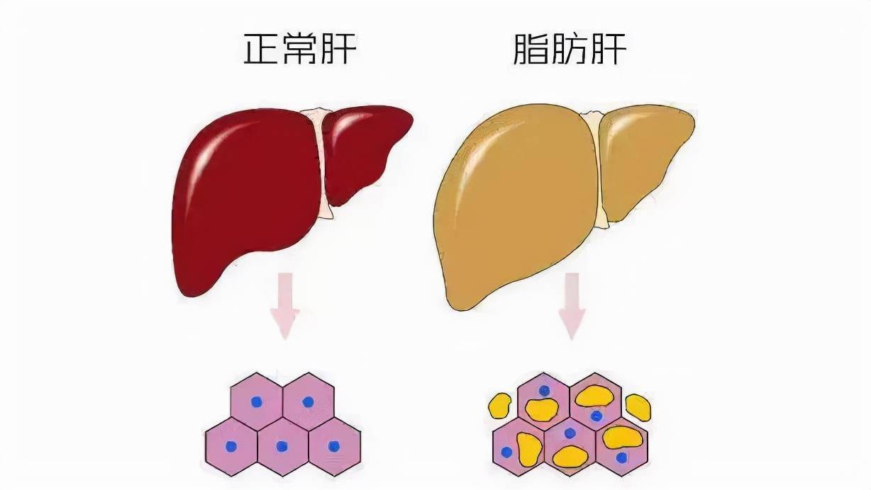 锌硒宝对肝好吗