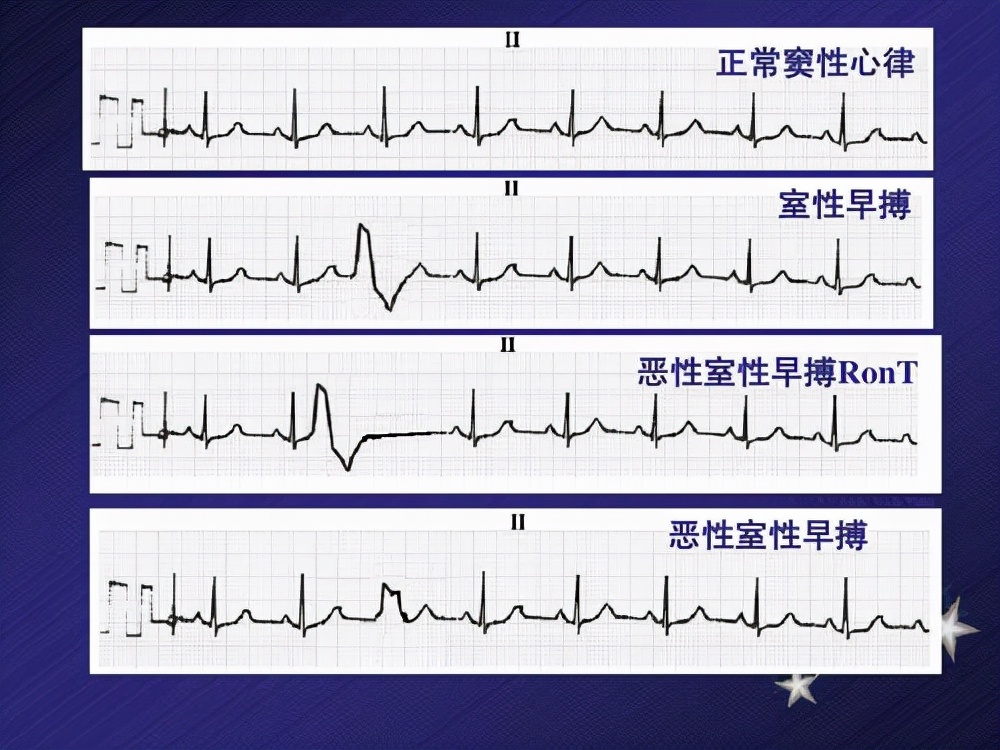 补硒对心脏病好吗