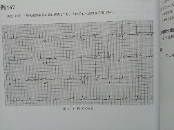 补硒对心脏病好吗