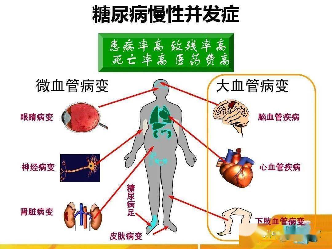 糖尿病补硒好不好