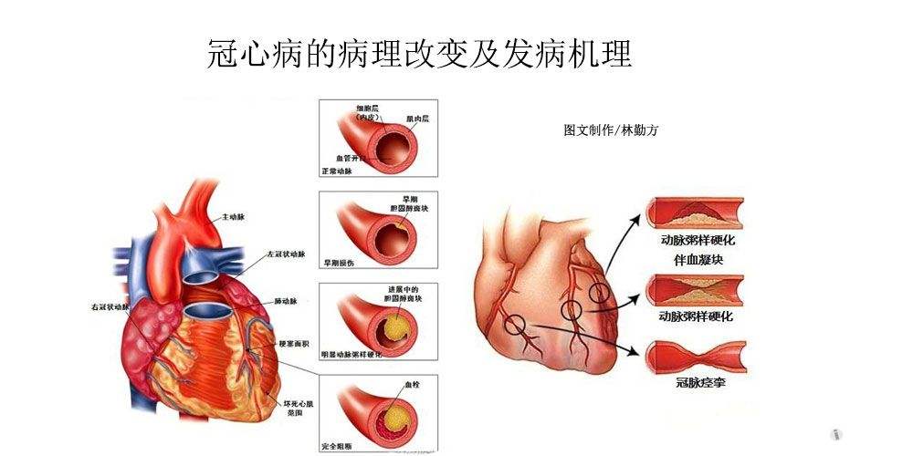 缺硒人群怎么补硒