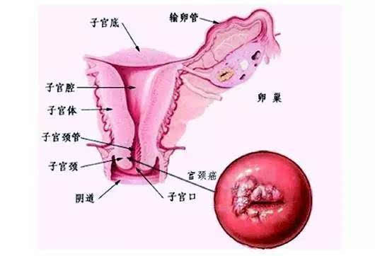 hpv高危阳补硒