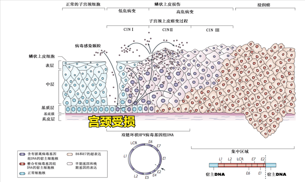 hpv高危阳补硒