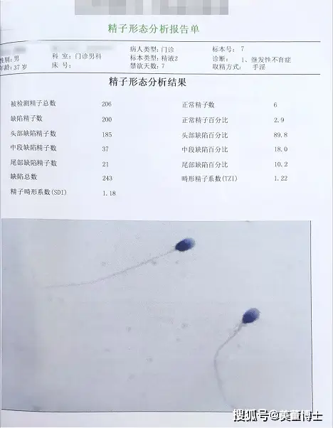 精液不液化 补硒