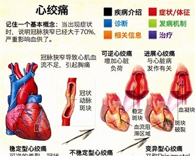 桥本甲亢补硒用药