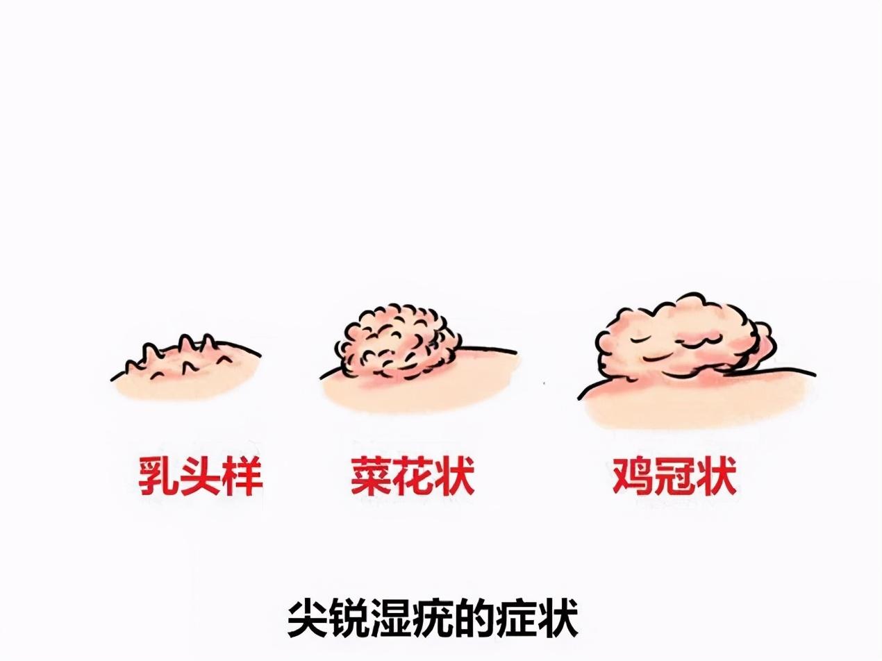 hpv高危型补硒