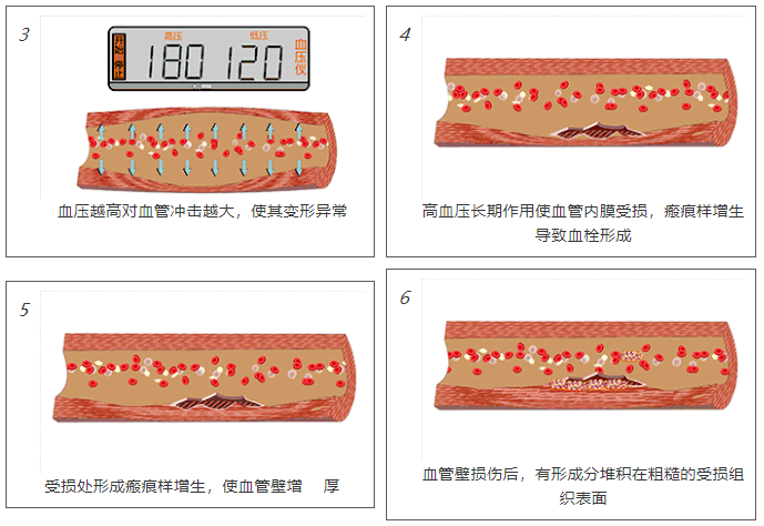 高血压补硒的好处