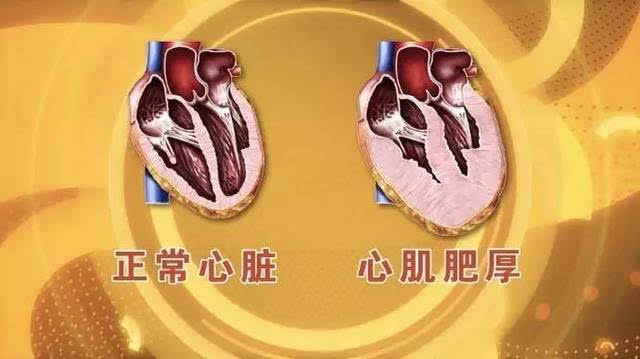 心梗患者怎样补硒