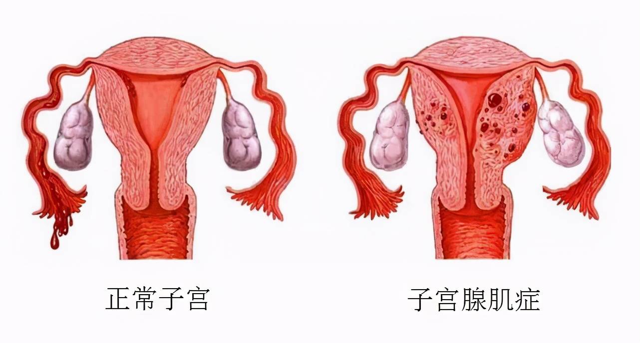 补硒治疗癌前病变