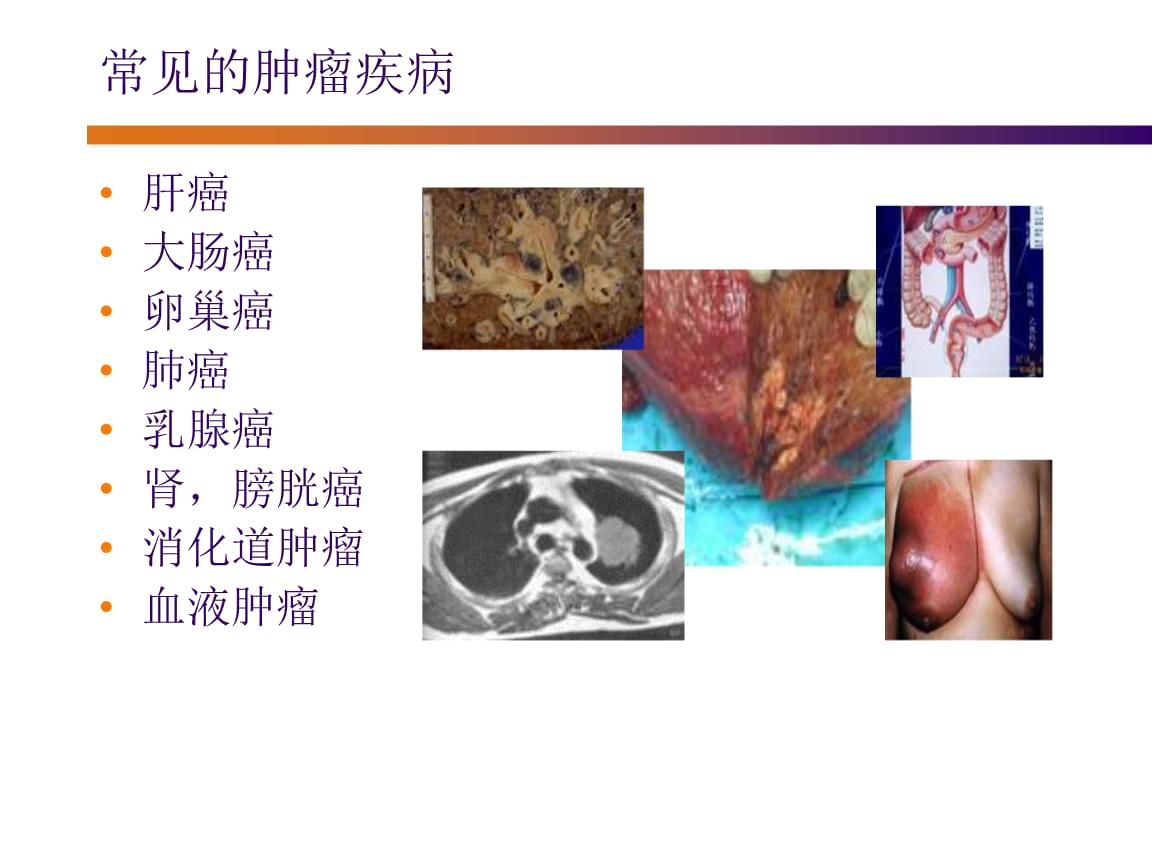 喉癌患者可补硒吗